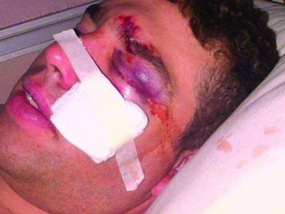 Lo golpearon salvajemente por ser umbandista
