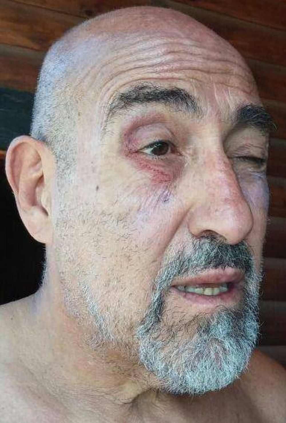 Jujuy: agredieron a Carlos �Perro� Santill�n