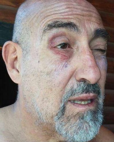 Jujuy: agredieron a Carlos �Perro� Santill�n