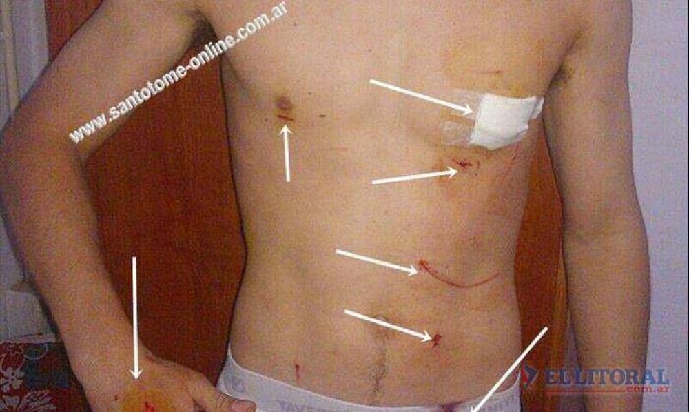 Preso obtuvo la libertad condicional y en un robo apu�al� a un estudiante