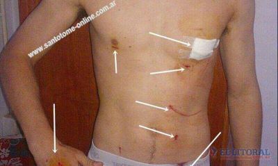 Preso obtuvo la libertad condicional y en un robo apu�al� a un estudiante