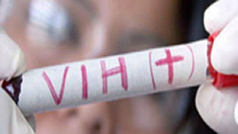 Por mes se diagnostican 50 casos de VIH