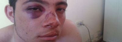 Fue agredido ferozmente por un aspirante a Polic�a en la salida de un baile