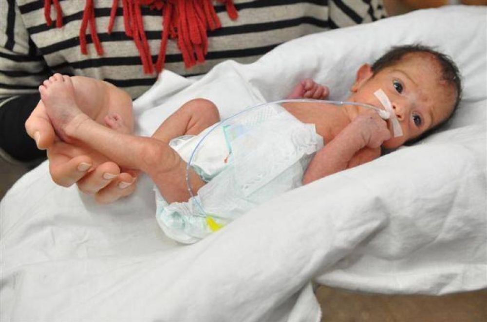 El Hospital Gandulfo realiz� el primer procedimiento con l�ser para tratar la retinopat�a en prematuros