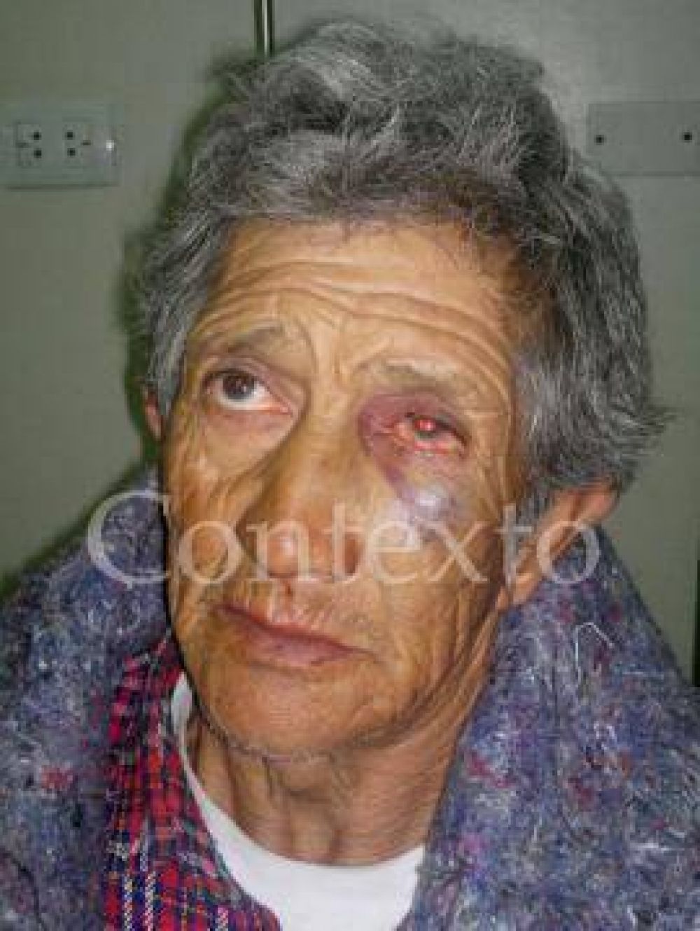 Denuncian al intendente de Taf� del Valle por brutal agresi�n a un vecino