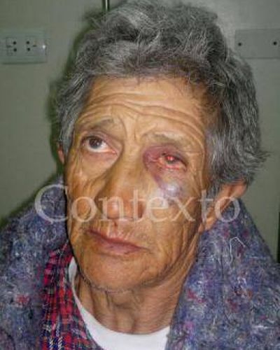Denuncian al intendente de Taf� del Valle por brutal agresi�n a un vecino