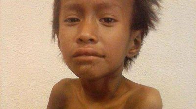 Chaco: muri� por desnutrici�n y tuberculosis un ni�o de 7 a�os