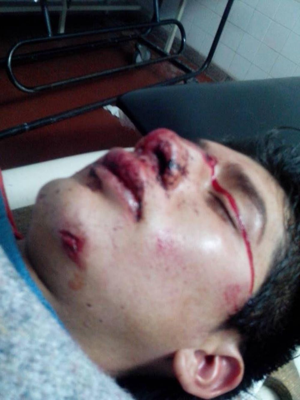 La Justicia investiga a los presuntos autores de una brutal golpiza a joven