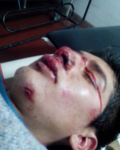 La Justicia investiga a los presuntos autores de una brutal golpiza a joven