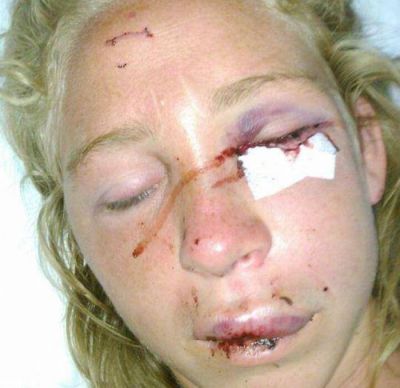 El Emvial anticip� sumario al empleado acusado por su pareja de golpeador