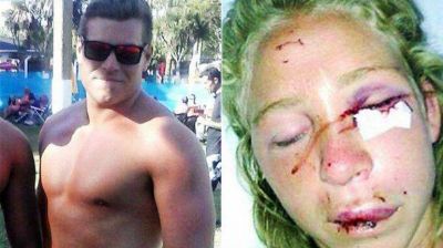 Detuvieron al acusado de golpear a su novia hasta desmayarla