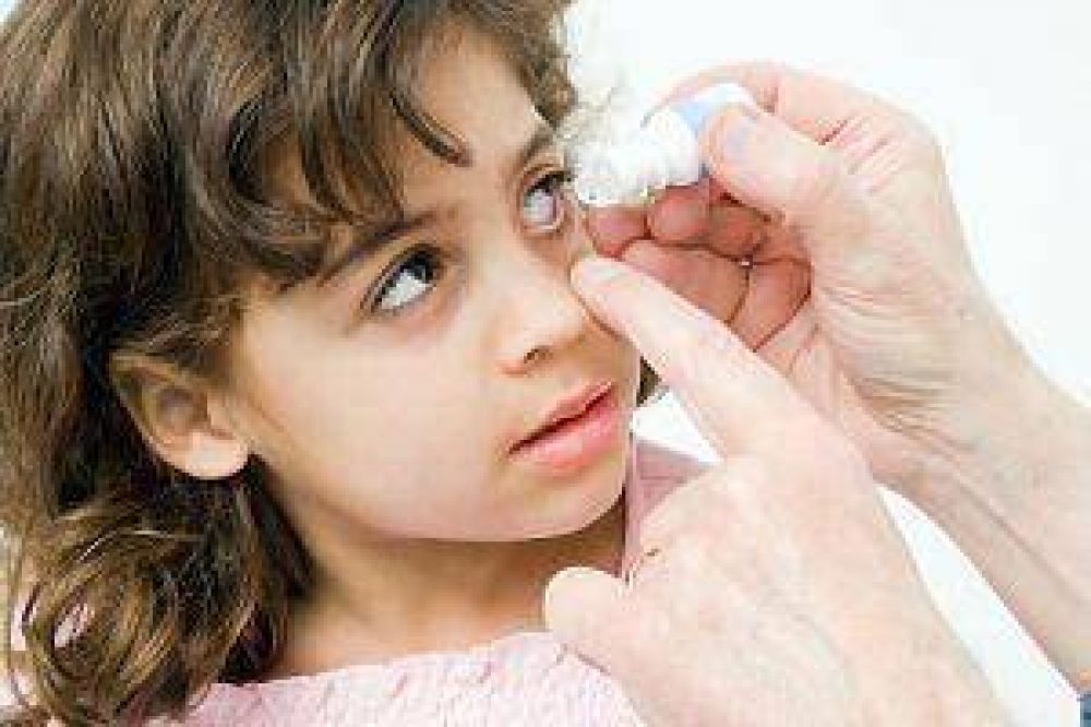 Alertan sobre el incremento de casos de conjuntivitis compleja en ni�os