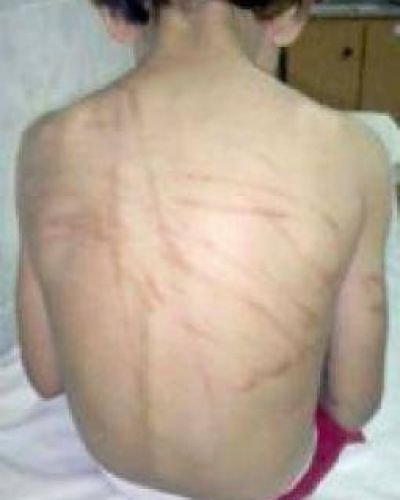 Bestia apresada por castigar brutalmente a su hijo de 6 a�os