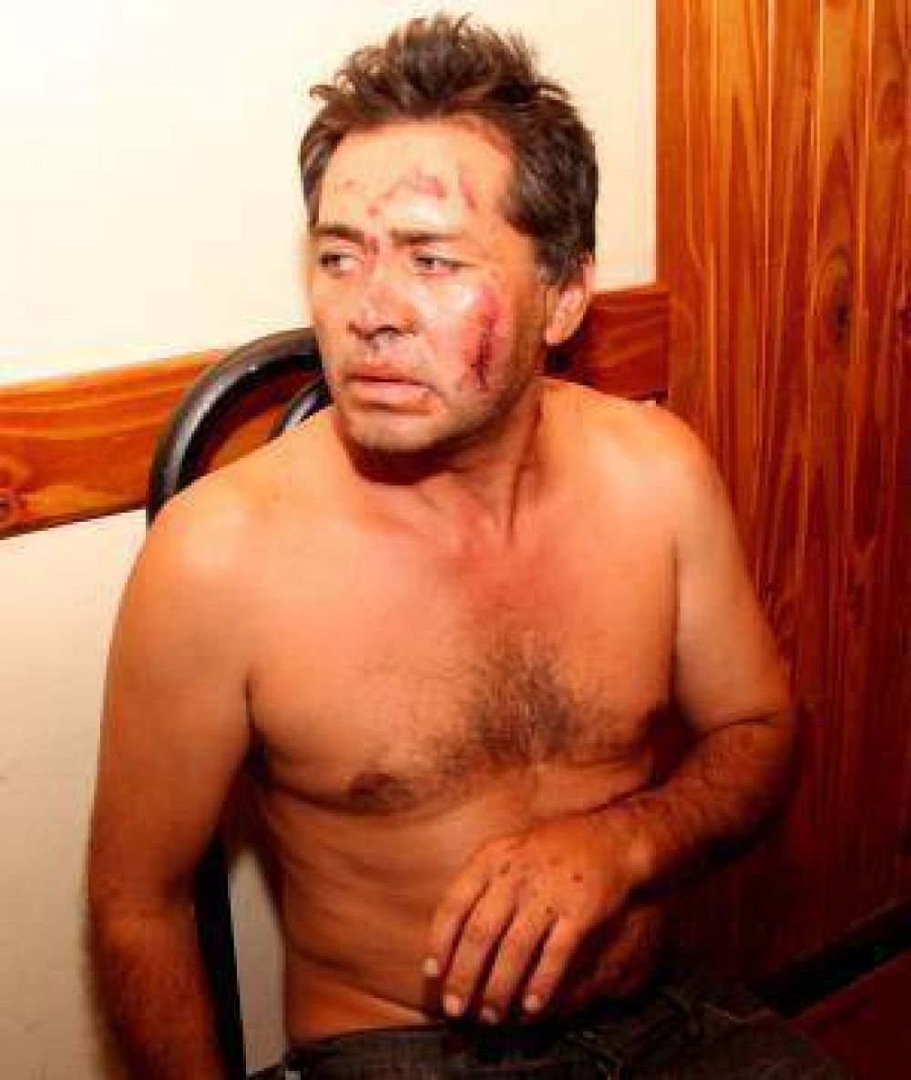 Lo apalearon y le cortaron la cara para robar su moto