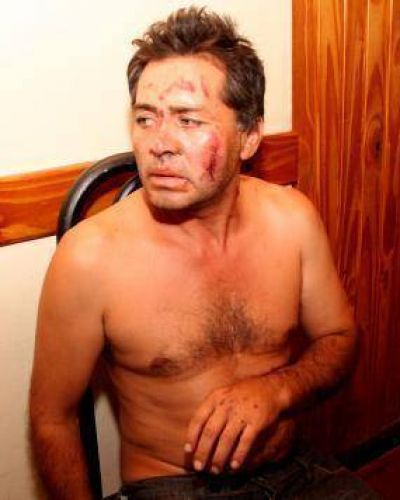 Lo apalearon y le cortaron la cara para robar su moto