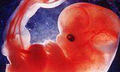 Aprueban por primera vez que un beb� tenga tres pap�s