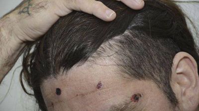 Dos polic�as que custodiaban una fiesta de 15 se emborracharon y balearon a los invitados