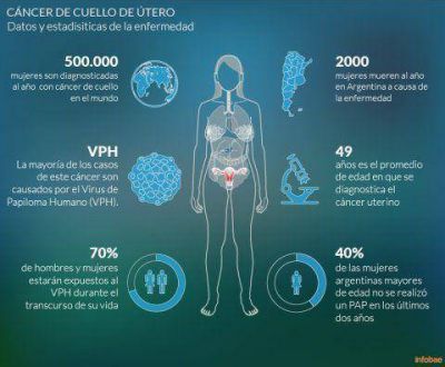 Se aprob� en la Argentina un nuevo tratamiento para el c�ncer de cuello de �tero