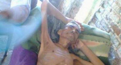 Otra muerte por desnutrici�n