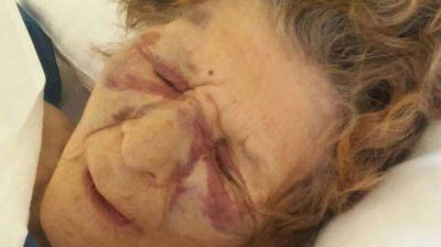 Golpean con un rebenque a una anciana para robarle en su casa