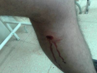Lo atacaron cinco perros y el due�o lo apunt� con un arma