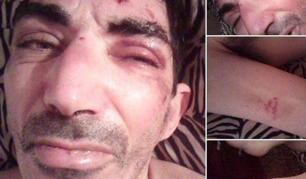 Iniciar�n sumario por el supuesto caso de maltrato en el Hospital Mental