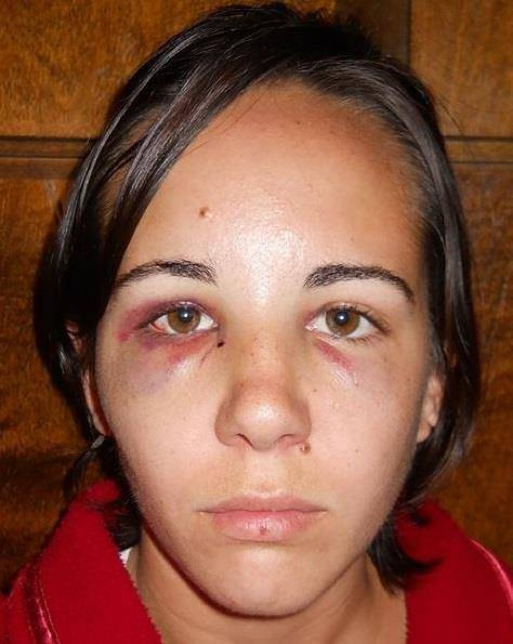 Una joven denunci� haber sido salvajemente golpeada por su novio
