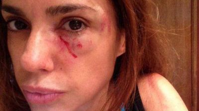 Una periodista denunci� que la agredieron en la v�a p�blica