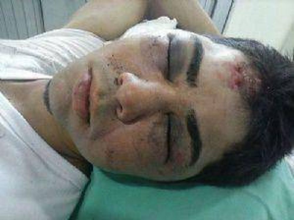 Brutal ataque de una patota a un joven a la salida de un boliche en Charata