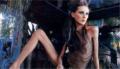 Anorexia: Francia planea pedirle certificado m�dico a las modelos