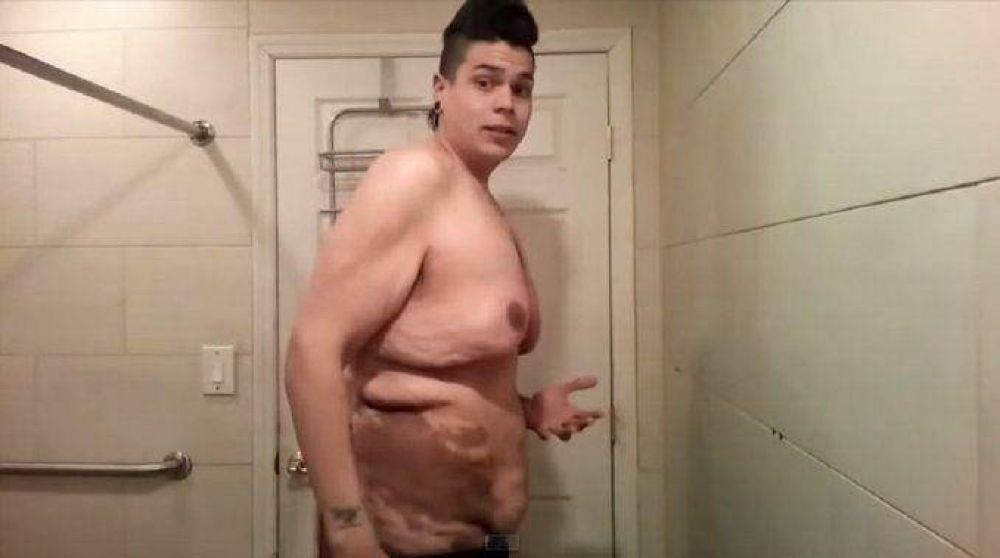 Un joven se anim� a mostrar c�mo qued� su cuerpo tras perder 122 kilos