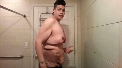 Un joven se anim� a mostrar c�mo qued� su cuerpo tras perder 122 kilos