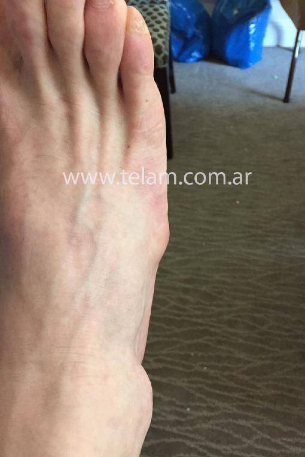 Messi sigue con el p�e inflamado