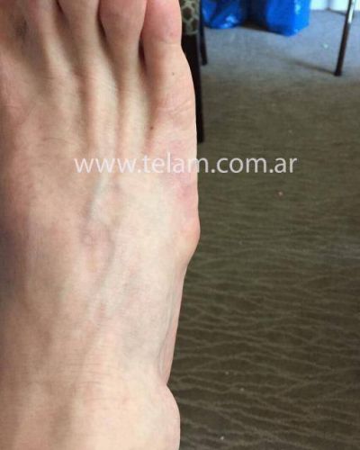 Messi sigue con el p�e inflamado