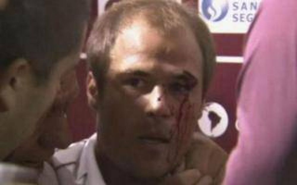 Violencia en el ftbol: Jugador de Lans fue agredido por un hincha