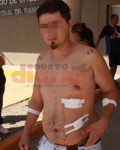 Fue atacado por ser hincha de otro club