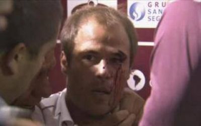 El jugador de Lan�s Mat�as Fritzler denunci� a su agresor