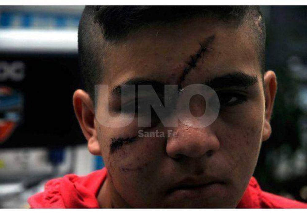 Brutal: polic�as le desfiguraron el rostro a un menor de 15 a�os