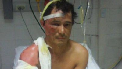 Alba�il internado dijo que la sac� barata luego de quedar electrocutado