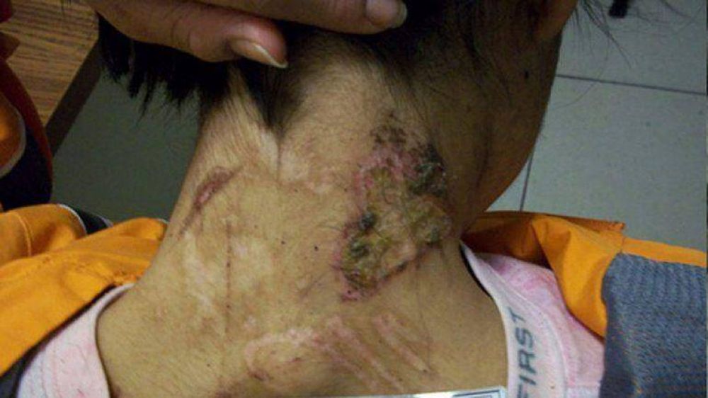 Joven mexicana vivi� dos a�os de esclavitud con torturas y pudo escapar para denunciarlo