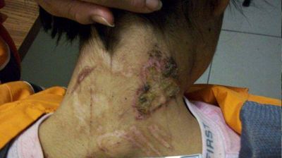Joven mexicana vivi� dos a�os de esclavitud con torturas y pudo escapar para denunciarlo
