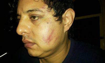 Motociclista denuncia una brutal golpiza de agentes del SAP