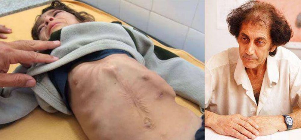 M�dico del sur tucumano revela c�mo hacen Alperovich, Manzur y Yedlin para esconder a los ni�os desnutridos 