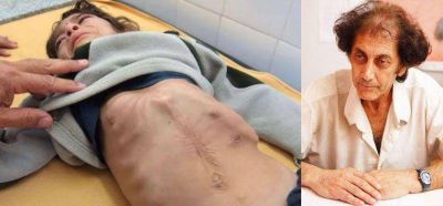 M�dico del sur tucumano revela c�mo hacen Alperovich, Manzur y Yedlin para esconder a los ni�os desnutridos 