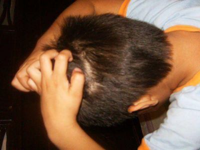 De las pulgas a los piojos: riesgos sanitarios injustificables
