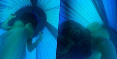 Vicky Xipolitakis se quem� el cuerpo con la cama solar: 