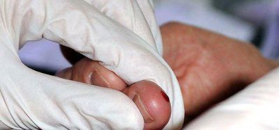 Testeos gratuitos para detectar hepatitis C
