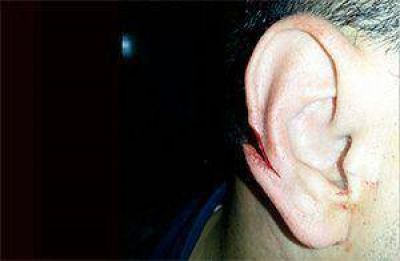 Lo atrapan, intenta escapar y le cort� la oreja a un polic�a
