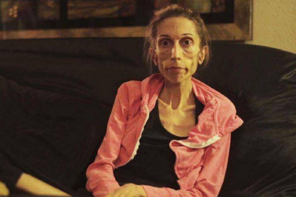 Una mujer anor�xica pide ayuda en internet para salvar su vida