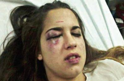 San Mart�n de los Andes : Joven desfigurada por brutal golpiza